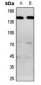 Anti-BAI1 Antibody